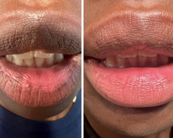 Dark lips Cream
