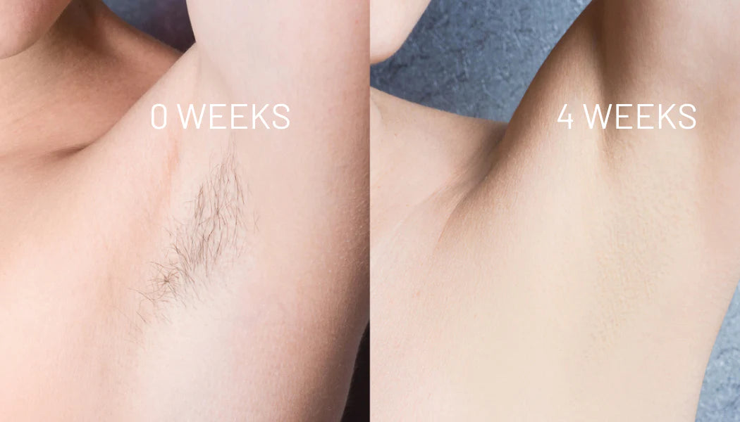Hair Removal Oil