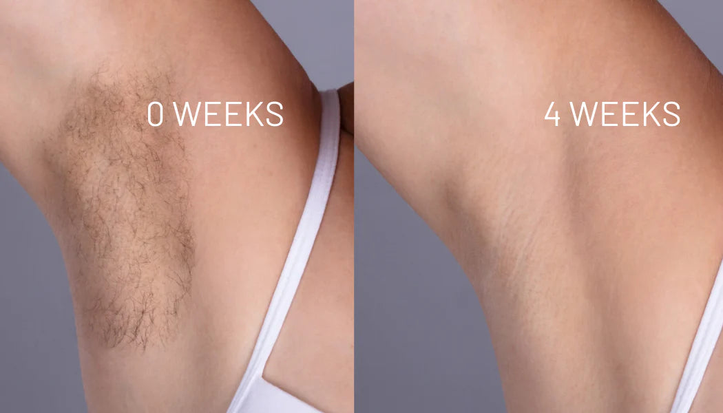 Hair Removal Oil