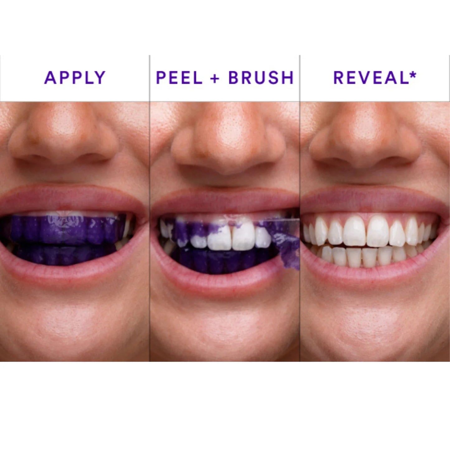 Purple Teeth Whitening Strips - 14 strips