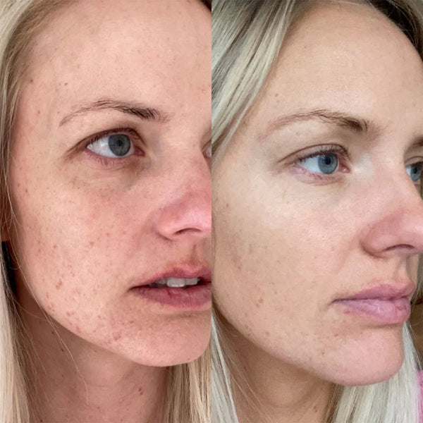 Vitamin C Dark Spots Brightening Cream