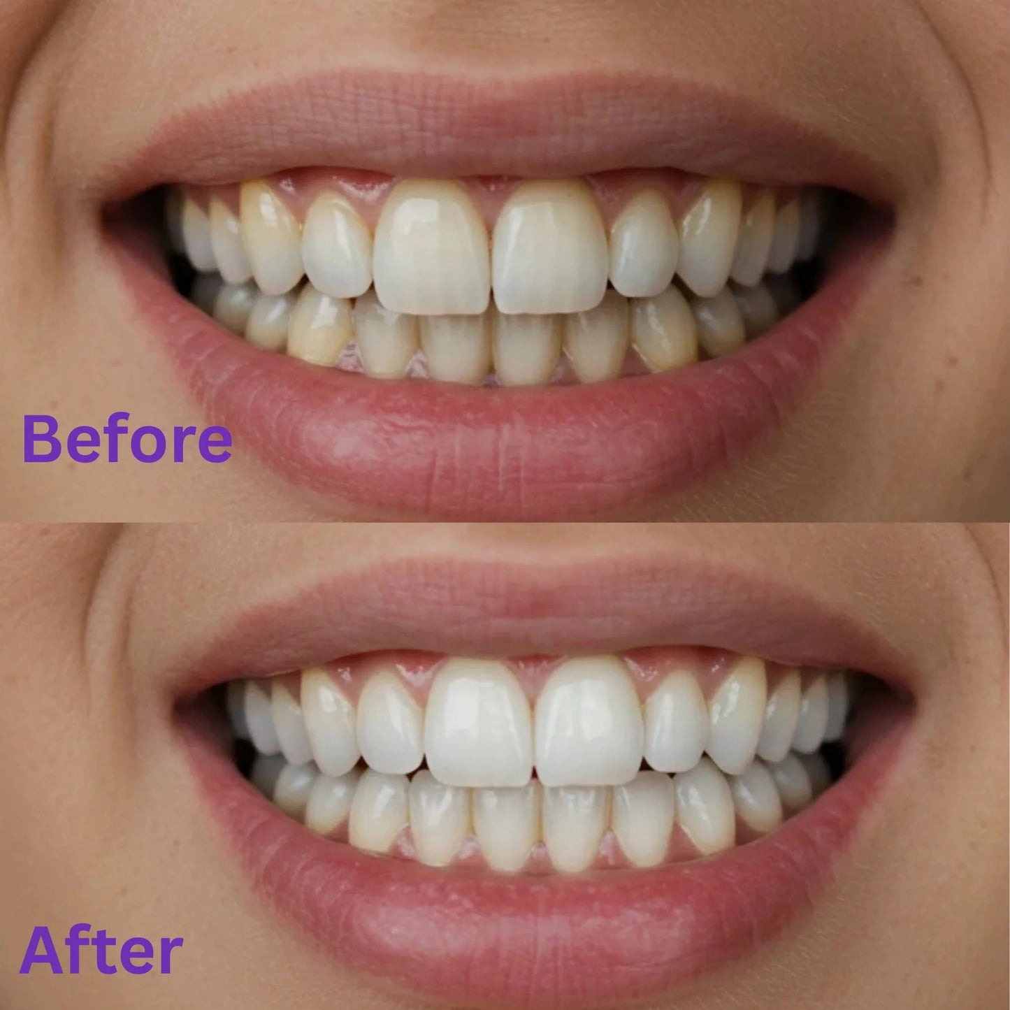 Purple Teeth Whitening Strips - 14 strips