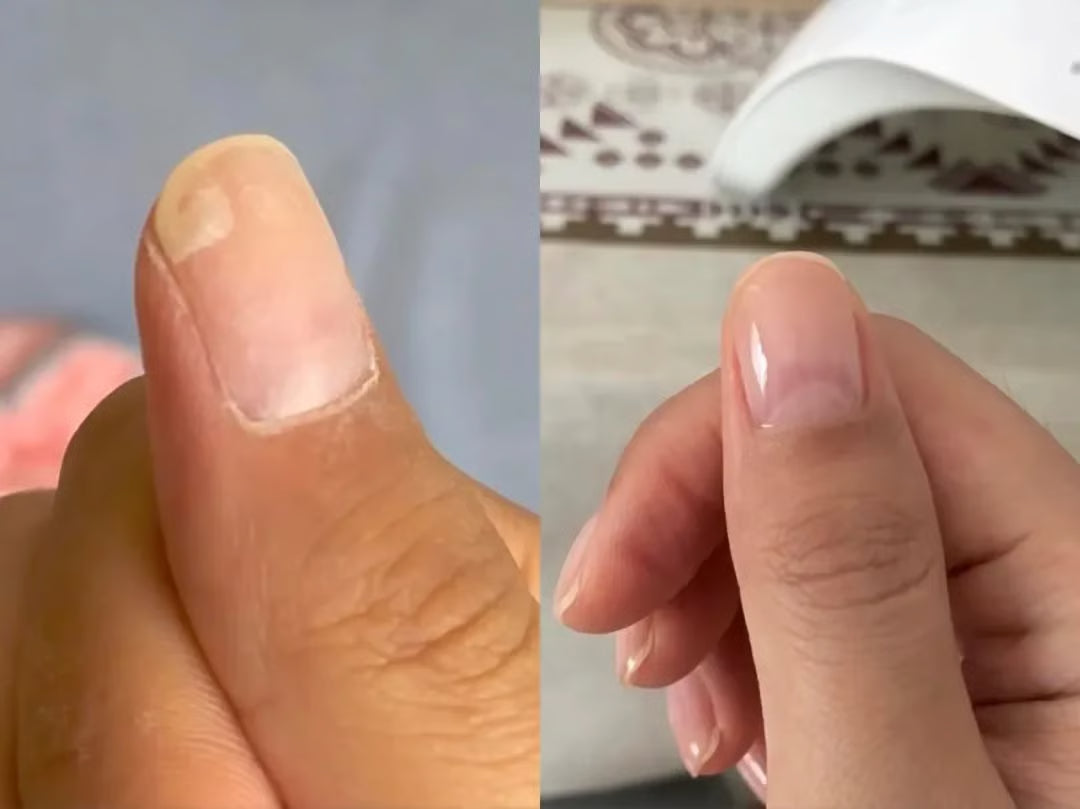 3 Days Nail Care Formula