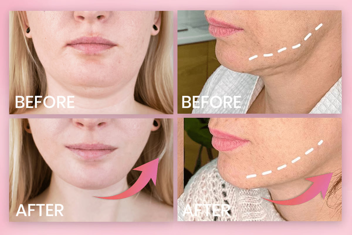 V-Face Lifting Invisible Adhesive Tape
