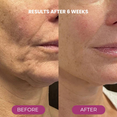 Anti-aging Calcium Volume Multi Balm