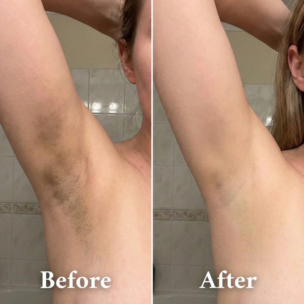 Peel Shot - Kojic + Turmeric Body Peel Spray