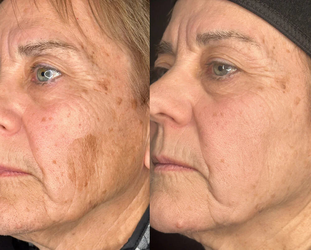 Korean Advanced Arbutin Brightening Cream