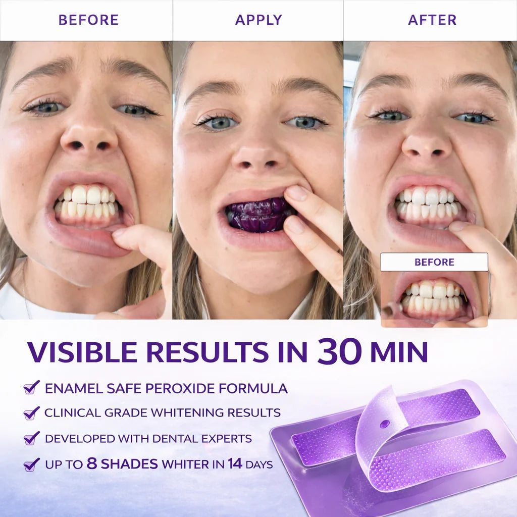 Purple Teeth Whitening Strips - 14 strips