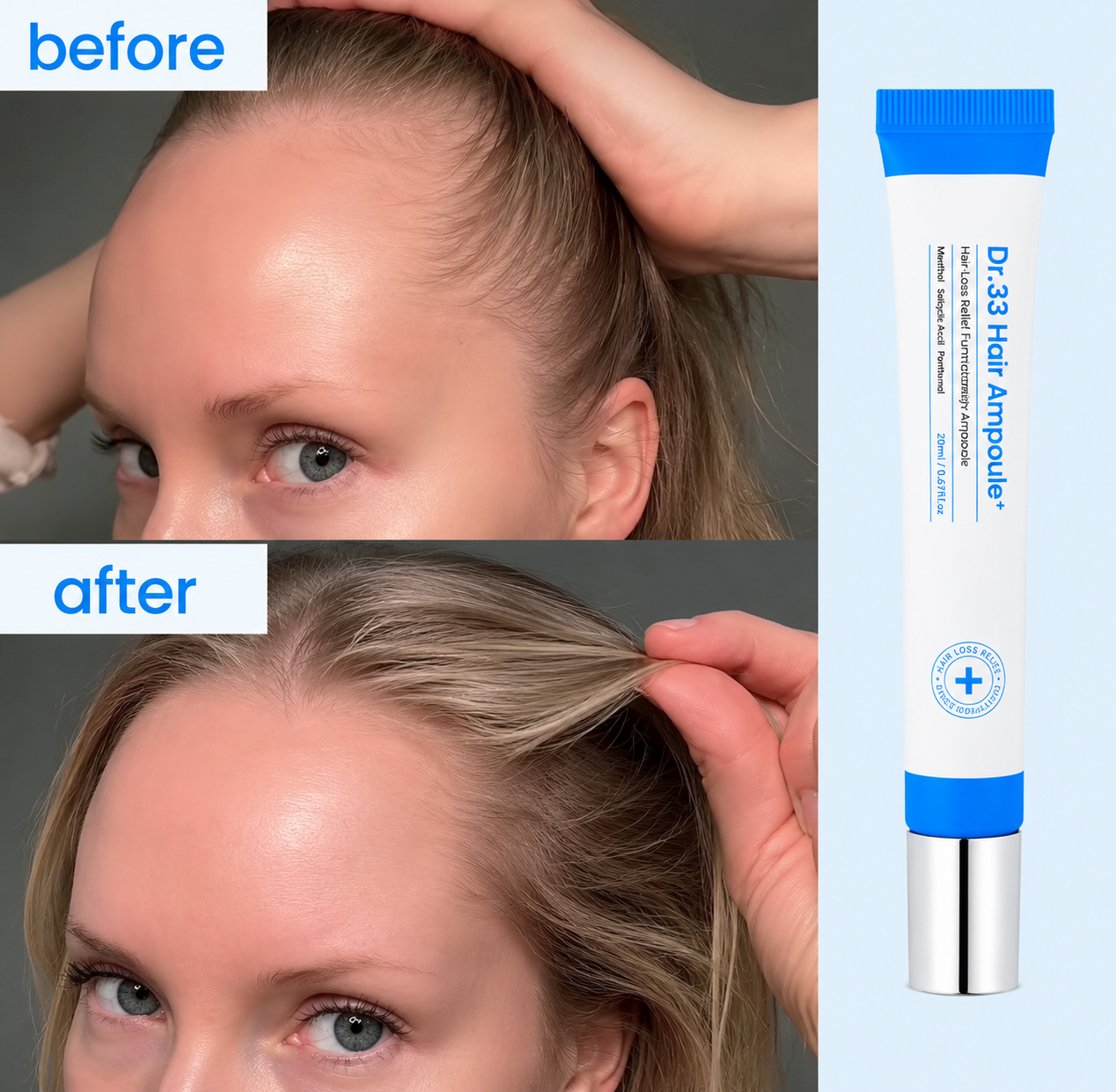 Scalpy Hair Growth Ampoule