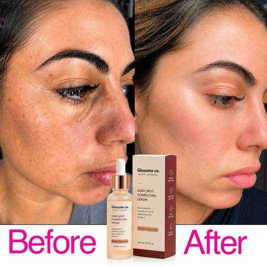 Dark Spot Correcting Serum