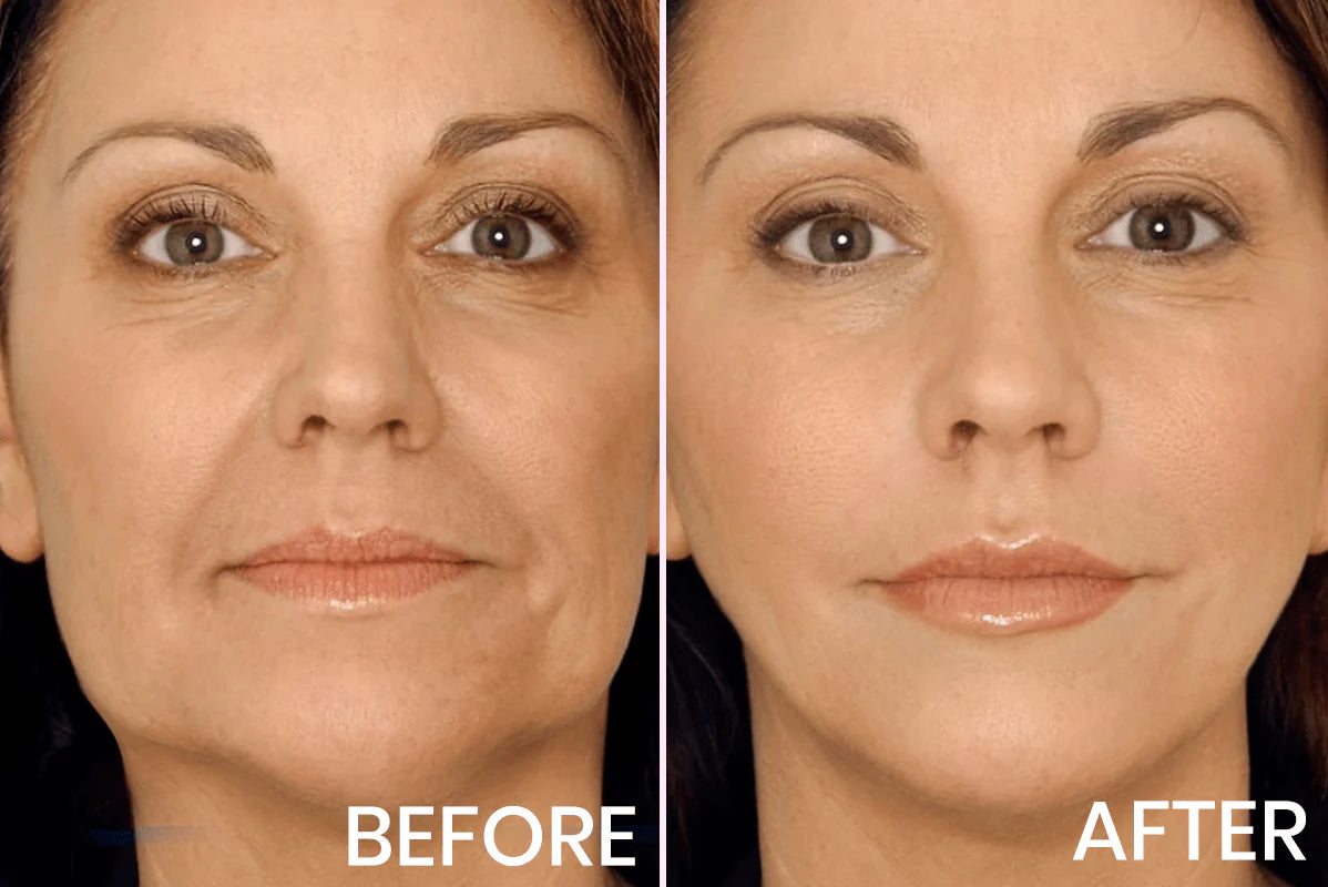 V-Face Lifting Invisible Adhesive Tape