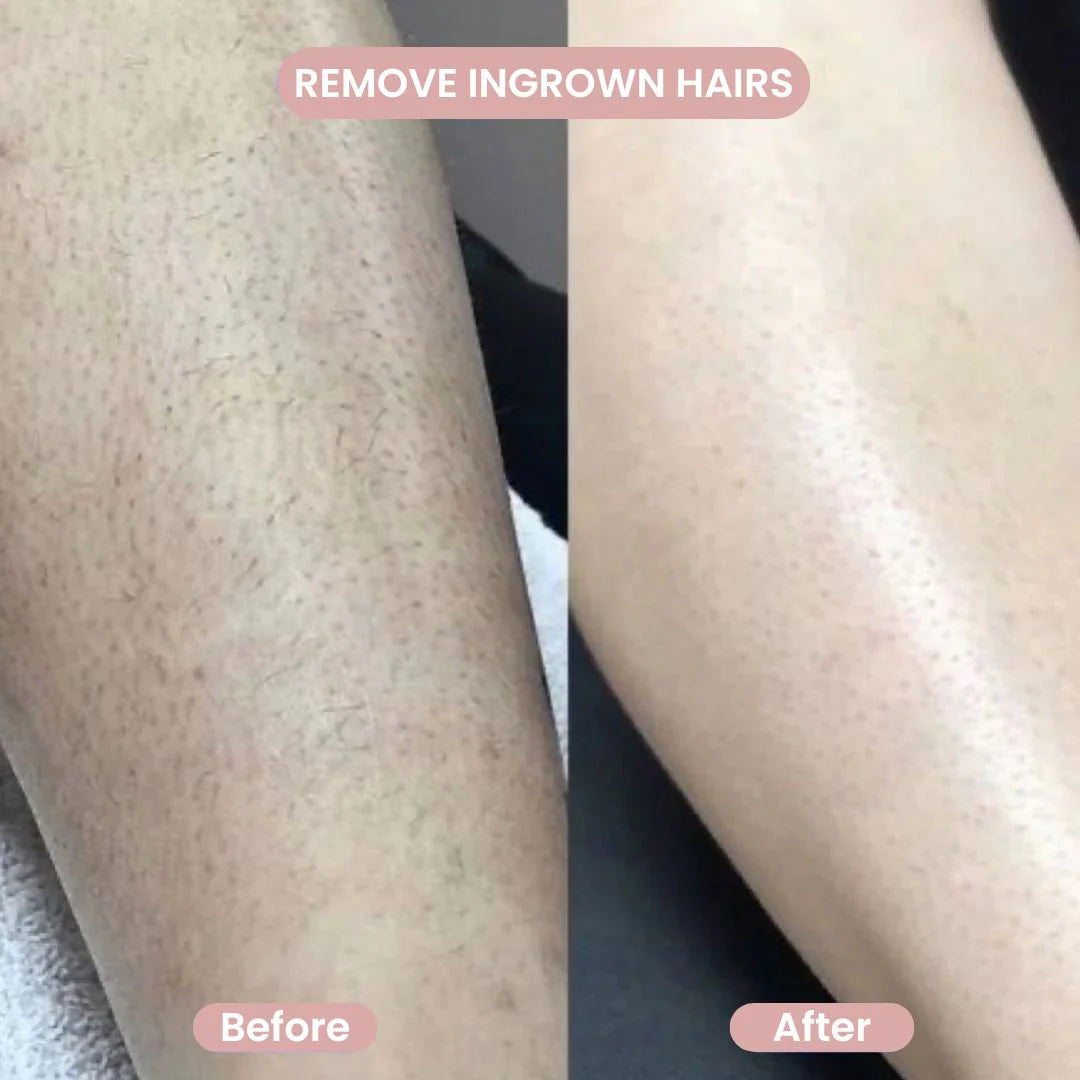 2‑in‑1 Bikini & Body Trimmer