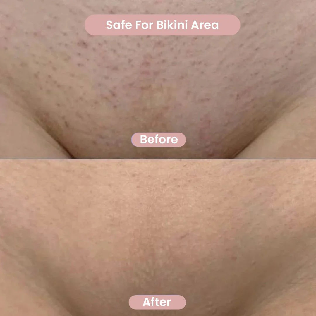 2‑in‑1 Bikini & Body Trimmer