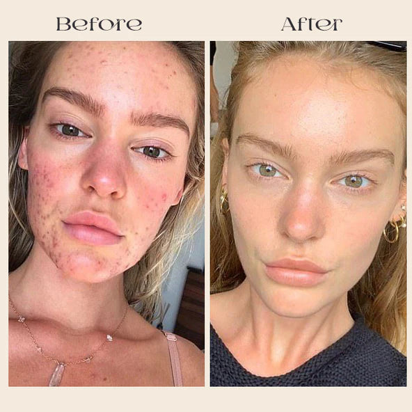 Korean Advanced Arbutin Brightening Cream