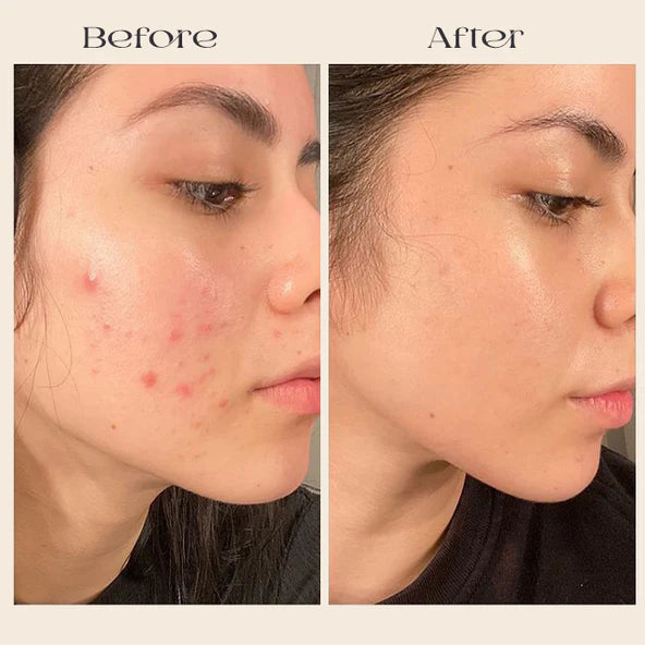 Korean Advanced Arbutin Brightening Cream