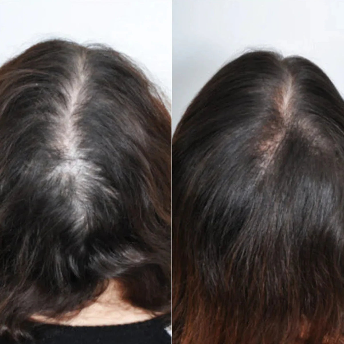 Scalpy Hair Growth Ampoule