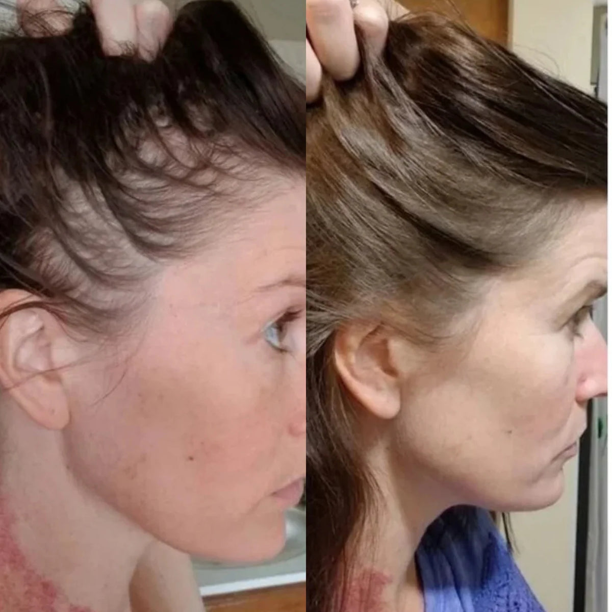 Scalpy Hair Growth Ampoule