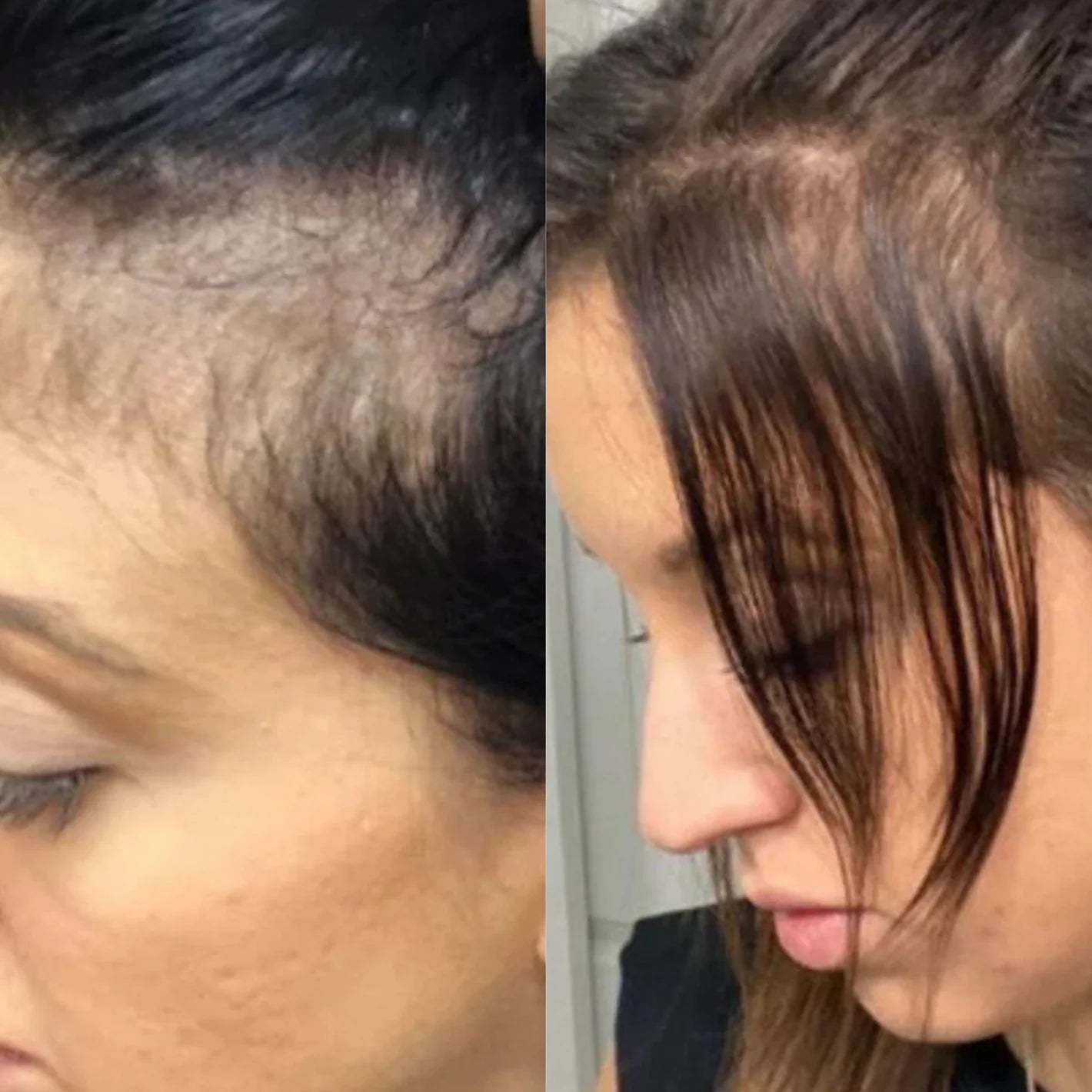 Scalpy Hair Growth Ampoule