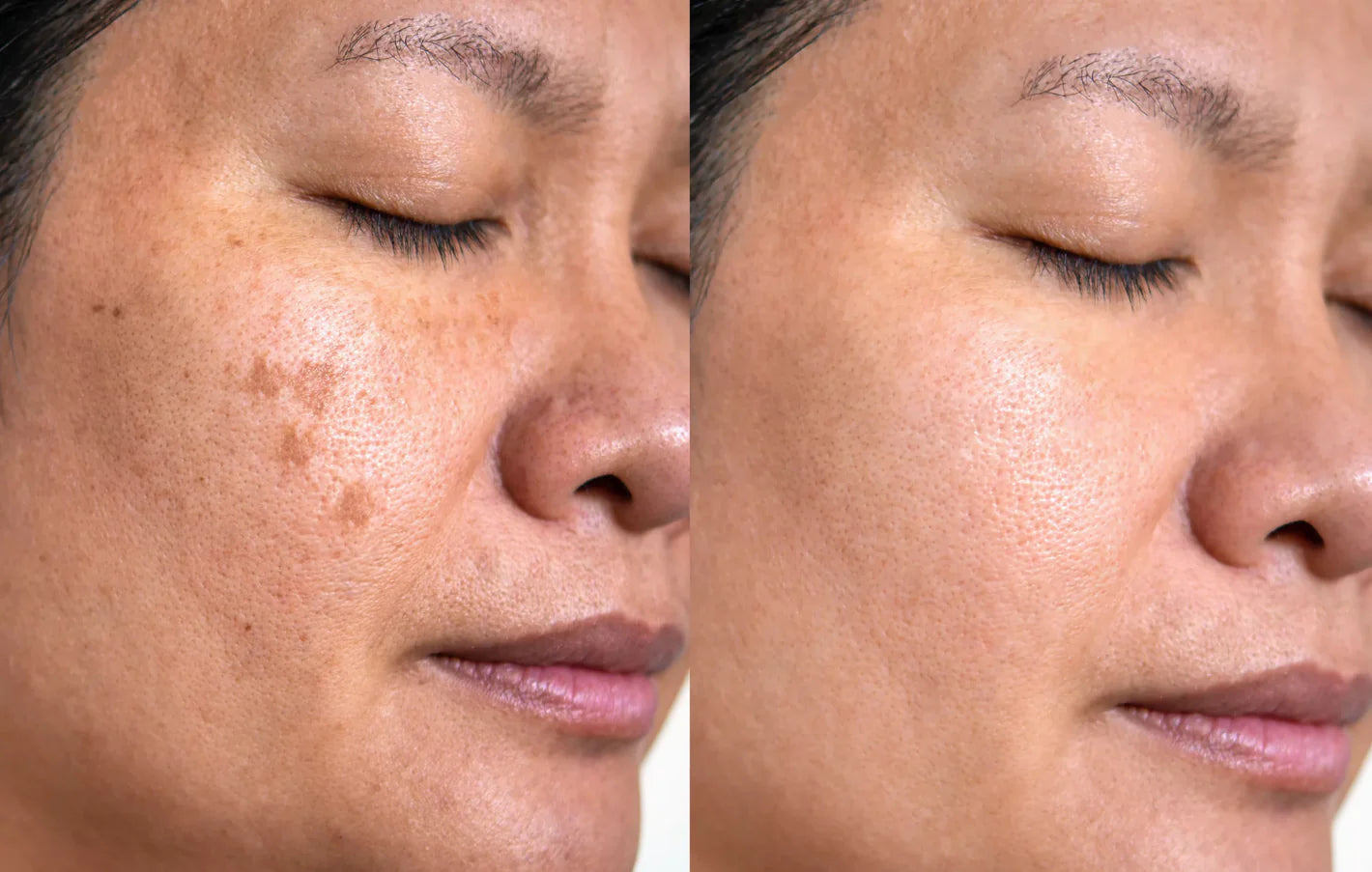 Korean Advanced Arbutin Brightening Cream