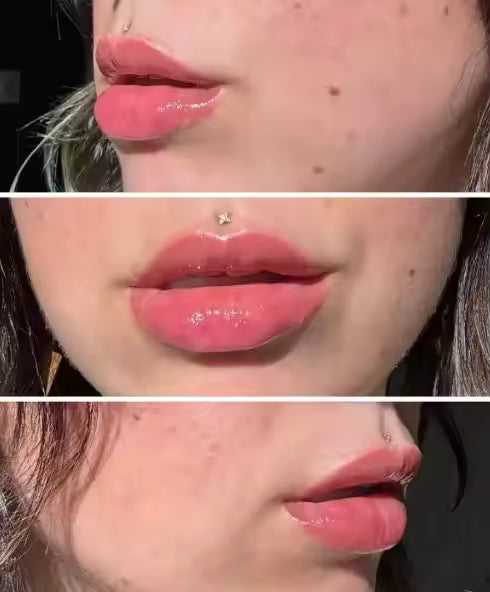 Spicule Plumping Lip Shot
