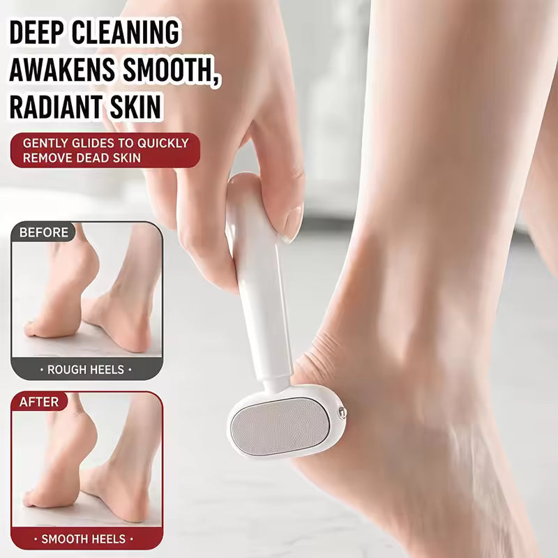 Foot Callus Remover