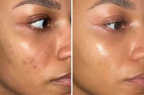 Dark Spots Brightening Essence