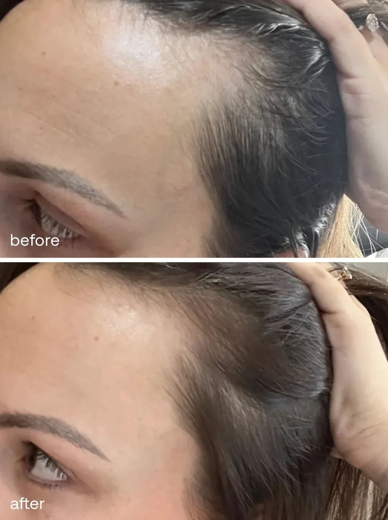 Scalpy Hair Growth Ampoule