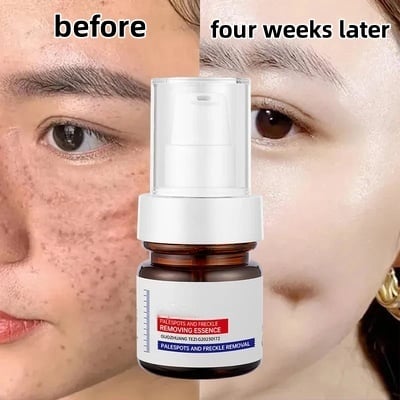 Dark Spots Brightening Essence
