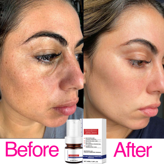 Dark Spots Brightening Essence