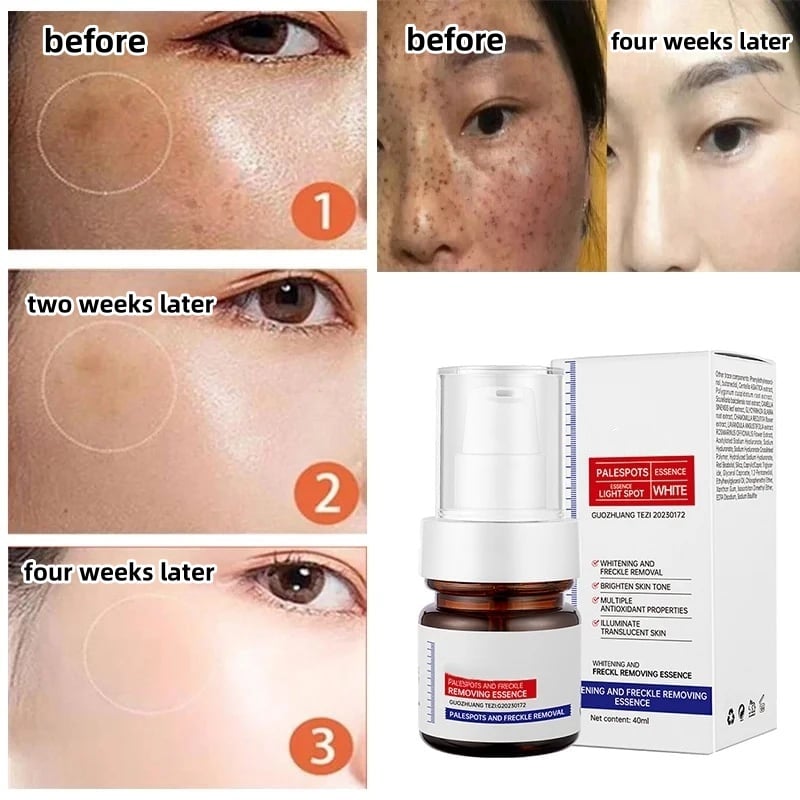 Dark Spots Brightening Essence