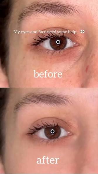 Vitamin C Booster Shot