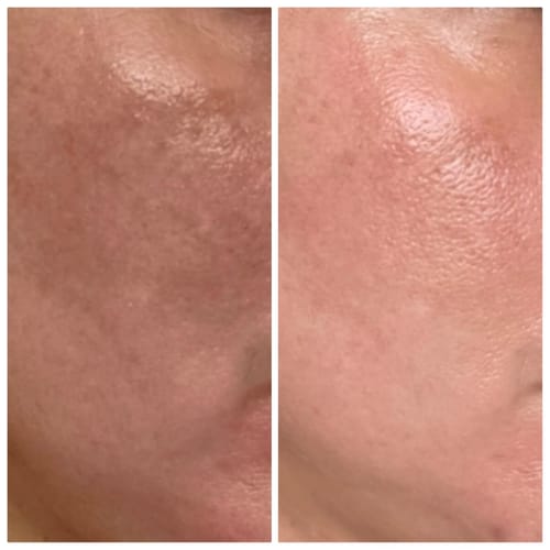 Korean Advanced Arbutin Brightening Cream