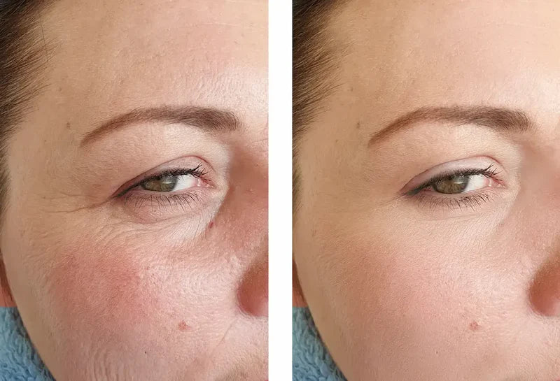 Dark Spots Brightening Essence