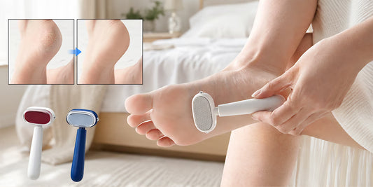 Foot Callus Remover